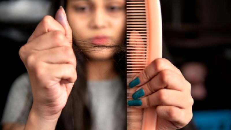 5 ways to avoid hair loss during the rainy season