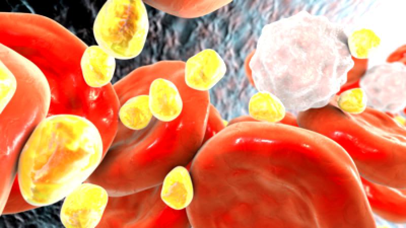 Signs of Elevated Cholesterol Levels in Men and Strategies for Reversing Them