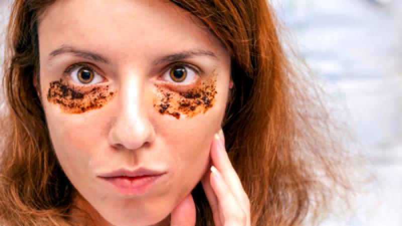 Conditions that lead to dark circles under the eyes